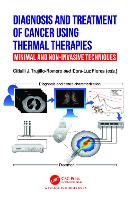Book Cover for Diagnosis and Treatment of Cancer using Thermal Therapies by Citlalli (National Institute of Rehabilitation, Maxico) J. Trujillo Romero