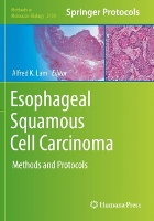 Book Cover for Esophageal Squamous Cell Carcinoma by Alfred K. Lam