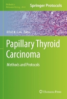 Book Cover for Papillary Thyroid Carcinoma by Alfred K. Lam