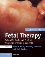 Book Cover for Fetal Therapy by Mark D. (University of Birmingham) Kilby