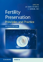 Book Cover for Fertility Preservation by Jacques Donnez