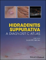 Book Cover for Hidradenitis Suppurativa by Giuseppe (Dermatology Clinic, University of Catania, Italy) Micali