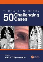 Book Cover for Thoracic Surgery: 50 Challenging cases by Wickii (Chief of Thoracic Surgery, Department of Thoracic and Cardiovascular Surgery, Loyola University Health Sys Vigneswaran