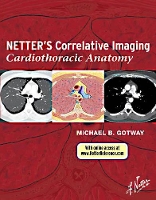 Book Cover for Netter's Correlative Imaging: Cardiothoracic Anatomy by Michael B. Gotway