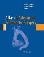 Book Cover for Atlas of Advanced Endoaortic Surgery by Jacques Kpodonu