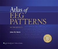 Book Cover for Atlas of EEG Patterns by John M. Stern