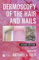 Book Cover for Dermoscopy of the Hair and Nails by Antonella Tosti