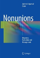 Book Cover for Nonunions by Animesh Agarwal