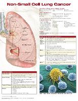 Book Cover for Non-Small Cell Lung Cancer by Anatomical Chart Company