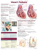 Book Cover for Heart Failure Anatomical Chart by Anatomical Chart Company