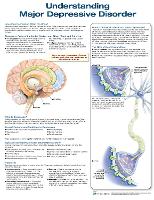 Book Cover for Understanding Major Depressive Disorder by Anatomical Chart Company