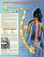 Book Cover for Understanding Multiple Sclerosis Anatomical Chart by Anatomical Chart Company