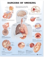 Book Cover for Dangers of Smoking Anatomical Chart by Anatomical Chart Company