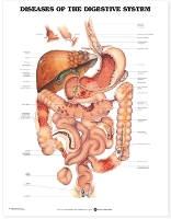 Book Cover for Diseases of the Digestive System Anatomical Chart by Anatomical Chart Company