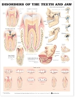 Book Cover for Disorders of the Teeth and Jaw Anatomical Chart by Anatomical Chart Company