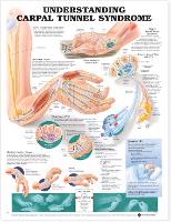 Book Cover for Understanding Carpal Tunnel Syndrome Anatomical Chart by Anatomical Chart Company