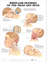 Book Cover for Whiplash Injuries of the Head and Neck Anatomical Chart by Anatomical Chart Company