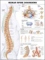 Book Cover for Human Spine Disorders Anatomical Chart by Anatomical Chart Company