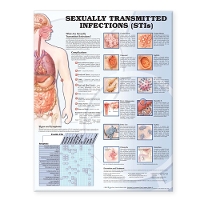 Book Cover for Sexually Transmitted Infections Anatomical Chart by Anatomical Chart Company