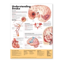 Book Cover for Understanding Stroke Anatomical Chart by Anatomical Chart Company