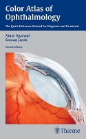 Book Cover for Color Atlas of Ophthalmology by Amar Agarwal