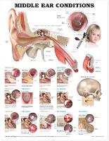 Book Cover for Middle Ear Conditions Anatomical Chart by Anatomical Chart Company