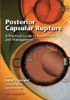 Book Cover for Posterior Capsular Rupture by Amar Agarwal