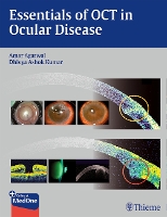 Book Cover for Essentials of OCT in Ocular Disease by Amar Agarwal