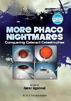 Book Cover for More Phaco Nightmares by Amar Agarwal