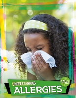 Book Cover for Understanding Allergies by Holly Duhig