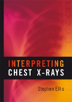 Book Cover for Interpreting Chest X-Rays by Stephen Ellis