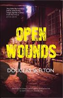 Book Cover for Open Wounds by Douglas Skelton