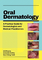 Book Cover for Oral Dermatology by SR Prabhu, Amanda Adjunct Associate Professor, Department of Medicine, University of Auckland, New Zealand Oakley, Su Yeoh