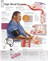 Book Cover for High Blood Pressure Paper Poster by Scientific Publishing