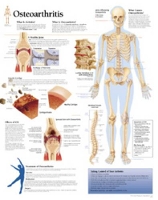 Book Cover for Osteoarthritis Laminated Poster by Scientific Publishing