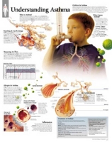 Book Cover for Understanding Asthma Laminated Poster by Scientific Publishing