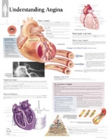 Book Cover for Understanding Angina Laminated Poster by Scientific Publishing