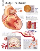 Book Cover for Effects of Hypertension Paper Poster by Scientific Publishing