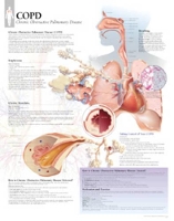 Book Cover for COPD (Chronic Obstructive Pulmonary Disease) Paper Poster by Scientific Publishing