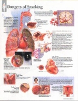 Book Cover for Effects of Smoking Laminated Poster by Scientific Publishing