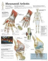 Book Cover for Rheumatoid Arthritis Paper Poster by Scientific Publishing