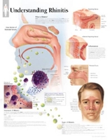 Book Cover for Understanding Rhinitis Paper Poster by Scientific Publishing