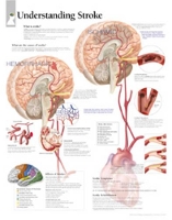 Book Cover for Understanding Stroke Paper Poster by Scientific Publishing