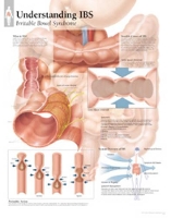 Book Cover for Understanding IBS Laminated Poster by Scientific Publishing