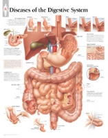 Book Cover for Diseases of the Digestive System Paper Poster by Scientific Publishing