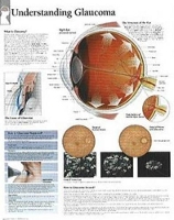 Book Cover for Understanding Glaucoma Paper Poster by Scientific Publishing