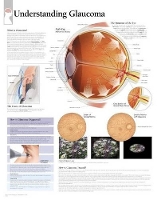 Book Cover for Understanding Glaucoma Laminated Poster by Scientific Publishing