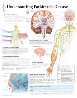 Book Cover for Understanding Parkinson's Laminated Poster by Scientific Publishing