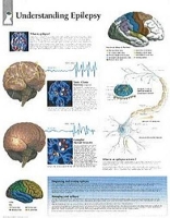 Book Cover for Understanding Epilepsy Laminated Poster by Scientific Publishing