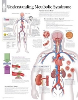 Book Cover for Understanding Metabolic Syndrome Laminated Poster by Scientific Publishing